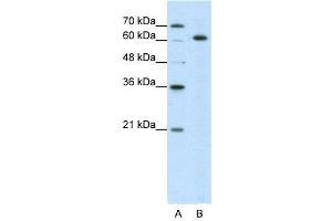 WB Suggested Anti-SNRP70  Antibody Titration: 5. (SNRNP70 Antikörper  (N-Term))