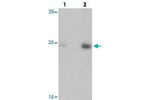 Western blot analysis of DRGX in rat liver tissue with DRGX polyclonal antibody  at (lane 1) 1 and (lane 2) 2 ug/mL. (DRGX Antikörper  (C-Term))