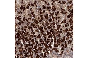 Immunohistochemical staining of human stomach with C6orf153 polyclonal antibody  shows strong cytoplasmic positivity in Parietal cells. (RRP36 Antikörper)