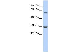 WB Suggested Anti-LPCAT1 Antibody Titration:  0. (LPCAT1 Antikörper  (Middle Region))