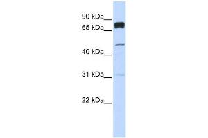 WB Suggested Anti-PLEKHA4 Antibody Titration:  0. (PLEKHA4 Antikörper  (Middle Region))