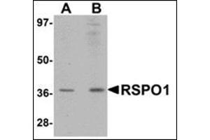 Western blot analysis of RSPO1 in rat spleen tissue lysate with this product at (A) 1 and (B) 2 μg/ml. (RSPO1 Antikörper  (N-Term))