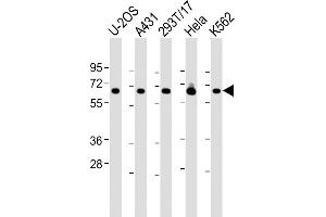 All lanes : Anti-RSL1D1 Antibody (C-Term) at 1:2000 dilution Lane 1: U-2OS whole cell lysate Lane 2: A431 whole cell lysate Lane 3: 293T/17 whole cell lysate Lane 4: Hela whole cell lysate Lane 5: K562 whole cell lysate Lysates/proteins at 20 μg per lane. (RSL1D1 Antikörper  (AA 455-485))