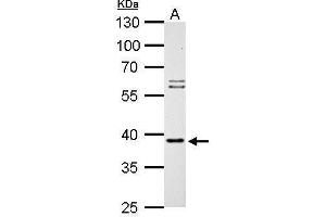 WB Image SAE1 antibody detects SAE1 protein by Western blot analysis. (SAE1 Antikörper)