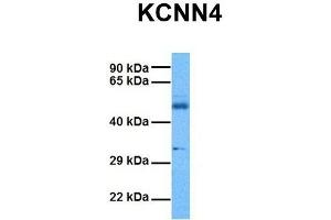Host:  Rabbit  Target Name:  KCNN4  Sample Tissue:  Human Ovary Tumor  Antibody Dilution:  1. (KCNN4 Antikörper  (C-Term))
