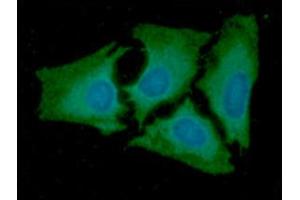 ICC/IF analysis of AK2 in HeLa cells line, stained with DAPI (Blue) for nucleus staining and monoclonal anti-human AK2 antibody (1:100) with goat anti-mouse IgG-Alexa fluor 488 conjugate (Green). (Adenylate Kinase 2 Antikörper  (AA 1-239))
