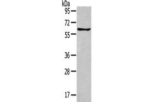 Gel: 8 % SDS-PAGE,Lysate: 40 μg,Primary antibody: ABIN7129612(GLP2R Antibody) at dilution 1/400 dilution,Secondary antibody: Goat anti rabbit IgG at 1/8000 dilution,Exposure time: 1 minute (GLP2R Antikörper)