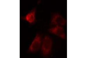 ABIN6275024 staining LOVO cells by IF/ICC. (CCDC102A Antikörper  (Internal Region))