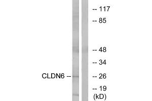 Western blot analysis of extracts from Jurkat cells, using CLDN6 antibody. (Claudin 6 Antikörper  (Internal Region))