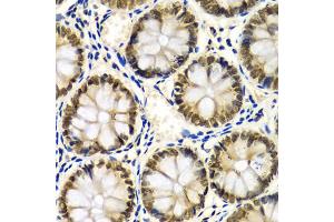 Immunohistochemistry of paraffin-embedded human colon using SNRPE Antibody (ABIN1876676) at dilution of 1:100 (40x lens). (SNRPE Antikörper)