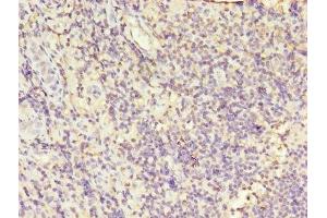 Immunohistochemistry of paraffin-embedded human tonsil tissue using ABIN7163557 at dilution of 1:100 (LCP1 Antikörper  (AA 2-627))