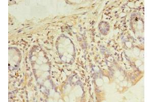 Immunohistochemistry of paraffin-embedded human small intestine tissue using ABIN7167776 at dilution of 1:100 (PDE6D Antikörper  (AA 1-150))