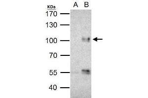 IP Image FOXO3A antibody immunoprecipitates FOXO3A protein in IP experiments.