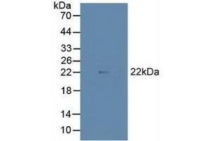 Detection of MAX in Porcine Heart Tissue using Polyclonal Antibody to MYC Associated Factor X (MAX) (MAX Antikörper  (AA 2-160))