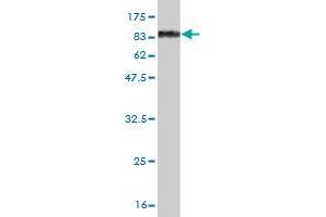 Western Blot detection against Immunogen (83. (OXSR1 Antikörper  (AA 1-527))