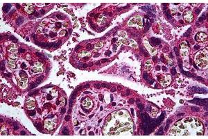 Human Placenta, Trophoblast: Formalin-Fixed, Paraffin-Embedded (FFPE) (ERBB3 Antikörper  (AA 1-131))