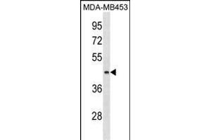 ALG8 Antibody (N-term) (ABIN1539057 and ABIN2850016) western blot analysis in MDA-M cell line lysates (35 μg/lane). (ALG8 Antikörper  (N-Term))