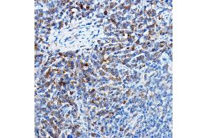 Immunohistochemistry of paraffin-embedded mouse spleen using Bax Rabbit mAb  at dilution of 1:25,1:50 (40x lens). (BAX Antikörper)