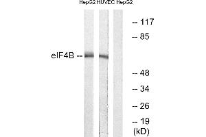 Immunohistochemistry analysis of paraffin-embedded human colon carcinoma tissue using eIF4B (Ab-422) antibody. (EIF4B Antikörper)