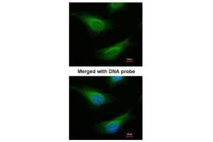 ICC/IF Image Immunofluorescence analysis of paraformaldehyde-fixed HeLa, using FANCC, antibody at 1:200 dilution. (FANCC Antikörper  (Center))