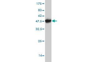 Western Blotting (WB) image for anti-Acid Phosphatase 1, Soluble (ACP1) (AA 1-158) antibody (ABIN559750)
