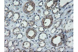 Image no. 4 for anti-Chromosome 2 Open Reading Frame 62 (C2orf62) antibody (ABIN1497054) (C2orf62 Antikörper)