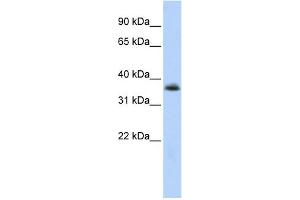 WB Suggested Anti-MNX1 Antibody Titration:  0. (MNX1 Antikörper  (N-Term))