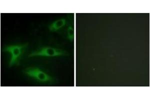 Immunofluorescence (IF) image for anti-Collagen, Type I, alpha 2 (COL1A2) (AA 471-520) antibody (ABIN2879172) (COL1A2 Antikörper  (AA 471-520))