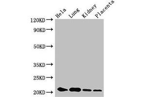 Western Blot Positive WB detected in: Hela whole cell lysate, Mouse lung tissue, Mouse kidney tissue, Human placenta tissue All lanes: KRBOX4 antibody at 3. (KRAB Box Domain Containing 4 (KRBOX4) (AA 1-98) Antikörper)
