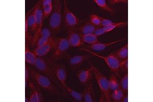 IF analysis of NDP52/CALCOCO2 using anti-NDP52/CALCOCO2 antibody (ABIN7599400).