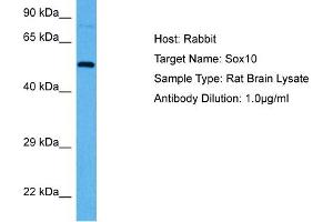 Host:  Rabbit  Target Name:  SOX10  Sample Tissue:  Rat Brain  Antibody Dilution:  1ug/ml (SOX9 Antikörper  (C-Term))