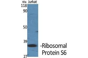Western Blot (WB) analysis of specific cells using Ribosomal Protein S6 Polyclonal Antibody. (RPS6 Antikörper  (Thr826))