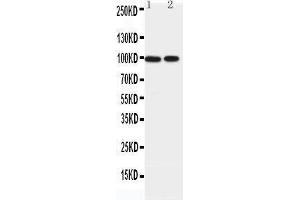 Western Blotting (WB) image for anti-erythrocyte Membrane Protein Band 4.1-Like 1 (EPB41L1) (AA 585-604), (C-Term) antibody (ABIN3042566) (EPB41L1 Antikörper  (C-Term))