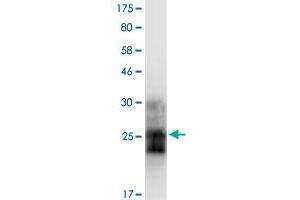 Image no. 2 for Tumor Necrosis Factor Receptor Superfamily, Member 10a (TNFRSF10A) (AA 103-239) protein (His-DYKDDDDK-Strep II Tag) (ABIN1323139)