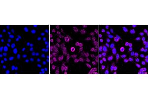 anti-Dyskeratosis Congenita 1, Dyskerin (DKC1) antibody