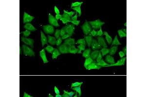 Immunofluorescence analysis of MCF-7 cells using RHOH Polyclonal Antibody (RHOH Antikörper)