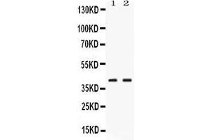 Western blot analysis of PSAT1 expression in rat pancreas extract ( Lane 1) and HELA whole cell lysates ( Lane 2). (PSAT1 Antikörper  (AA 276-370))
