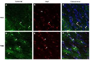 Immunohistochemical staining of perfusion-fixed frozen rat brain sections derived from post-natal day 22 (PN22) and from post-natal day 60 (PN60), using Anti-TMEM108 (extracellular) Antibody (ABIN7885615), followed by goat anti-rabbit- and Anti-OLIG2 Antibody, followed by goat anti-mouse-biotin and streptavidin-Cy3. (TMEM108 Antikörper  (Extracellular Loop))