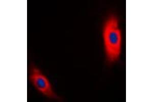 Immunofluorescent analysis of CK1 alpha staining in MCF7 cells. (CSNK1A1 Antikörper  (Center))