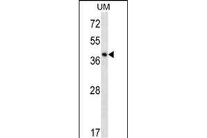 SPOPL Antibody (Center) (ABIN656695 and ABIN2845929) western blot analysis in uterus tumor cell line lysates (35 μg/lane). (SPOPL Antikörper  (AA 221-249))