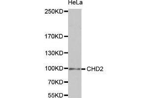 Western Blotting (WB) image for anti-Chromodomain Helicase DNA Binding Protein 2 (CHD2) antibody (ABIN1980262)