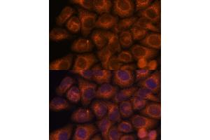 Immunofluorescence analysis of HeLa cells using SEC23IP antibody (ABIN7270170) at dilution of 1:100. (SEC23IP Antikörper  (AA 600-940))