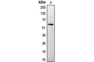 Western blot analysis of Caspase 8 (pS347) expression in Jurkat PMA-treated (A) whole cell lysates. (Caspase 8 Antikörper  (pSer347))
