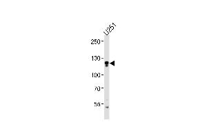 ECE2 Antibody (Center) (ABIN1881279 and ABIN2843411) western blot analysis in  cell line lysates (35 μg/lane).