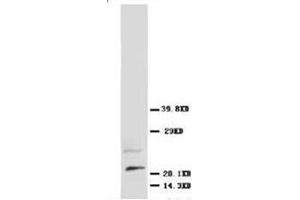 Western blot analysis of rat brain tissue lysis using NGFbeta antibody (Nerve Growth Factor Antikörper  (N-Term))