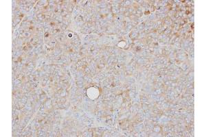 IHC-P Image Immunohistochemical analysis of paraffin-embedded SW480 xenograft, using PRPS1, antibody at 1:500 dilution. (PRPS1 Antikörper)