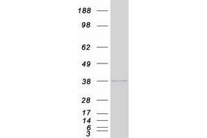 Western Blotting (WB) image for Histone Cluster 1, H1c (HIST1H1C) protein (Myc-DYKDDDDK Tag) (ABIN2722795)