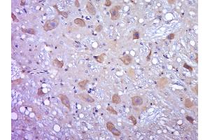 Paraformaldehyde-fixed, paraffin embedded rat brain, Antigen retrieval by boiling in sodium citrate buffer (pH6. (OGFOD2 Antikörper  (AA 101-200))