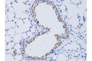 Immunohistochemistry of paraffin-embedded mouse lung using AQP4 antibody. (Aquaporin 4 Antikörper)