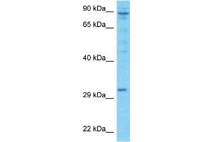 Host:  Rabbit  Target Name:  LRC52  Sample Type:  ACHN Whole Cell lysates  Antibody Dilution:  1. (LRRC52 Antikörper  (Middle Region))